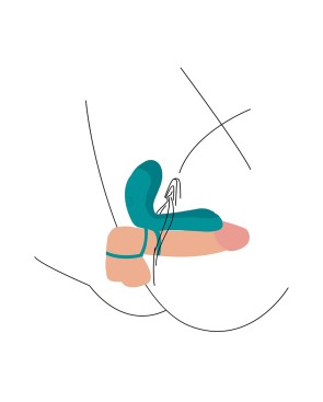 Anneau vibromasseur pour couple - Xocoon